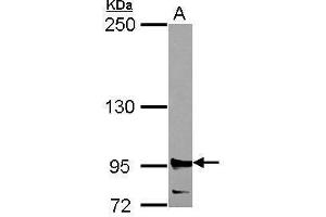 WB Image Sample (30 ug of whole cell lysate) A: 293T 5% SDS PAGE antibody diluted at 1:2000 (RRM1 Antikörper  (Center))