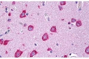 Anti-MLKL antibody IHC staining of human brain, cortex neurons. (MLKL Antikörper  (AA 371-472))