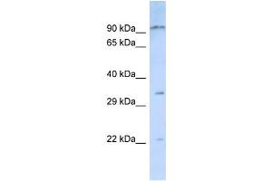 Host:  Rabbit  Target Name:  NIPSNAP3B  Sample Type:  Jurkat Whole Cell lysates  Antibody Dilution:  1. (NIPSNAP3B Antikörper  (N-Term))