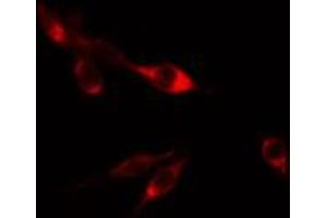 ABIN6274803 staining HepG2 cells by IF/ICC. (ACBD6 Antikörper  (Internal Region))