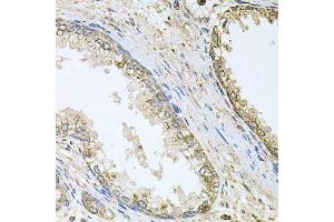 Immunohistochemistry of paraffin-embedded human prostate using CYP46A1 antibody (ABIN5996079) at dilution of 1/100 (40x lens). (CYP46A1 Antikörper)