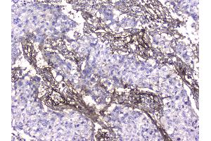 IHC analysis of Collagen IV using anti-Collagen IV antibody . (COL4A1 Antikörper  (AA 1445-1669))