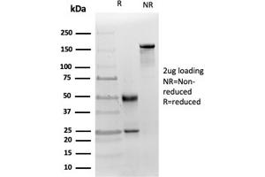 SDS-PAGE Analysis Purified MICA Mouse Recombinant Monoclonal (MICA/4442). (MICA Antikörper  (AA 1-200))