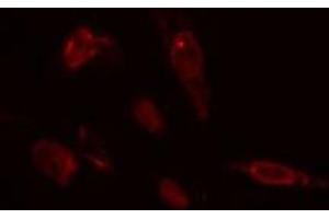 ABIN6275433 staining  COLO205 cells by IF/ICC.