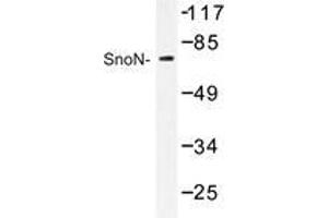 Western blot analysis of SnoN antibody in extracts from HUVEC cells. (SKIL Antikörper)