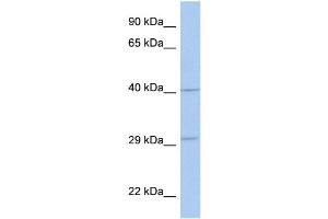 WB Suggested Anti-ART5 Antibody Titration:  0. (ART5 Antikörper  (Middle Region))