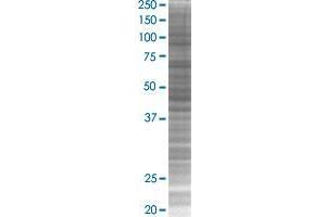 EPS8L2 transfected lysate. (EPS8L2 293T Cell Transient Overexpression Lysate(Denatured))