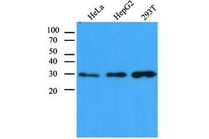 Western Blotting (WB) image for anti-Carbonyl Reductase 1 (CBR1) antibody (ABIN614308) (CBR1 Antikörper)