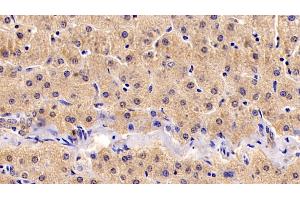 Immunohistochemistry (IHC) image for anti-Insulin-Like Growth Factor 1 (IGF1) (AA 49-118) antibody (ABIN7427897)