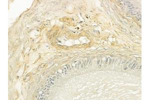 ABIN6260013 and ABIN6279138 at 1/100 staining human testicular cancer by IHC-P.
