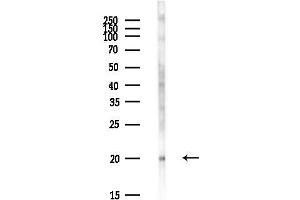 anti-Ubiquitin-Conjugating Enzyme E2E 1 (UBE2E1) antibody