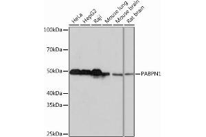 Western blot analysis of extracts of various cell lines, using P Rabbit mAb (ABIN7269445) at 1:1000 dilution. (PABPN1 Antikörper)