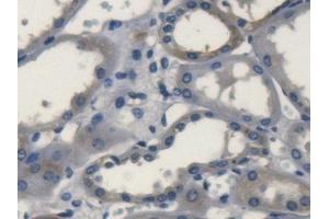 Immunohistochemistry (IHC) image for anti-Superoxide Dismutase 3, Extracellular (SOD3) (AA 19-240) antibody (ABIN7429196)