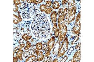 anti-Adaptor-Related Protein Complex 2, mu 1 Subunit (AP2M1) (AA 9-435) antibody