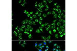 Immunofluorescence analysis of HeLa cells using C1QBP Polyclonal Antibody