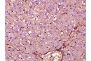 Paraformaldehyde-fixed, paraffin embedded rat liver section, Antigen retrieval by boiling in sodium citrate buffer (pH6) for 15min, Block endogenous peroxidase by 3% hydrogen peroxide for 30 minutes, Blocking buffer (normal serum) at 37°C for 20min, Antibody incubation with Fibronectin (1B9) Monoclonal Antibody  at 1:200 overnight at 4°C, followed by a conjugated secondary and DAB staining.