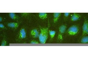 anti-Aldehyde Dehydrogenase 7 Family, Member A1 (ALDH7A1) (AA 333-369), (C-Term) antibody