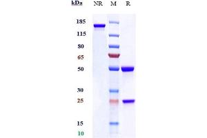 Anti-Klotho Beta Reference Antibody (RG7992) on SDS-PAGE under reducing (R) condition.