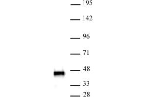 Western Blotting (WB) image for anti-SWI/SNF Related, Matrix Associated, Actin Dependent Regulator of Chromatin, Subfamily B, Member 1 (SMARCB1) antibody (ABIN6972743)