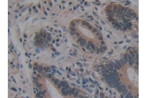 Immunohistochemistry (IHC) image for anti-Villin 1 (VIL1) (AA 1-320) antibody (ABIN7435034)
