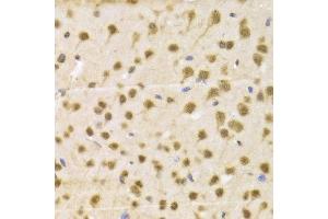 Immunohistochemistry of paraffin-embedded Mouse brain using NeuN antibody at dilution of 1:100 (x400 lens).