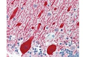 Immunohistochemical analysis of paraffin-embedded human brain cerebellum using AMACR mouse mAb. (AMACR Antikörper)