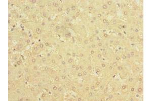 Immunohistochemistry (IHC) image for anti-3-hydroxybutyrate Dehydrogenase, Type 2 (BDH2) (AA 1-245) antibody (ABIN7142304)