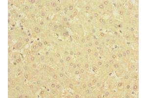 Immunohistochemistry of paraffin-embedded human liver tissue using ABIN7142304 at dilution of 1:100 (BDH2 Antikörper  (AA 1-245))