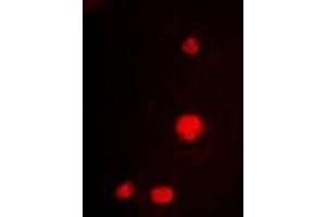 Immunofluorescent analysis of MCM3 staining in K562 cells. (MCM3 Antikörper)