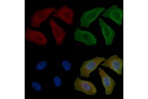 ABIN6264150 and ABIN6277603 staining Hela cells(45 min of heat-shock) by IF/ICC. (PEX19 Antikörper  (Internal Region))