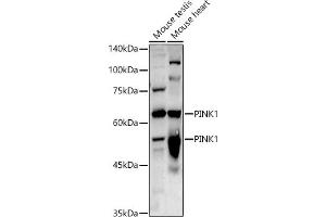 Western blot analysis of extracts of various cell lines, using PINK1 antibody (ABIN6128457, ABIN6145665, ABIN6145667 and ABIN6215214) at 1:1000 dilution. (PINK1 Antikörper  (AA 282-581))