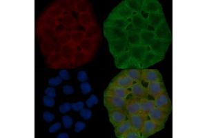 ABIN6264828 and ABIN6278632 staining Hela cells(30 min of UV treatment) by IF/ICC. (RPL14 Antikörper  (Internal Region))