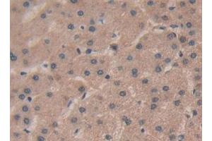 Immunohistochemistry (IHC) image for anti-R-Spondin 1 (RSPO1) (AA 21-135) antibody (ABIN7430144)