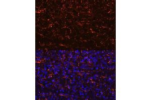 Immunofluorescence analysis of human spleen using CCR7 Rabbit mAb (ABIN7266309) at dilution of 1:100 (40x lens). (CCR7 Antikörper)