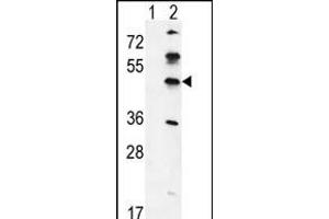 Western blot analysis of GK (arrow) using rabbit polyclonal GK Antibody (C-term) (ABIN651665 and ABIN2840349). (GKAP1 Antikörper  (C-Term))