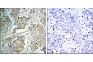 Immunohistochemistry (IHC) image for anti-VEGF Receptor 2 (VEGFR2) (AA 1180-1229), (pTyr1214) antibody (ABIN1531999)