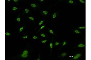 Immunofluorescence of monoclonal antibody to RERE on HeLa cell.