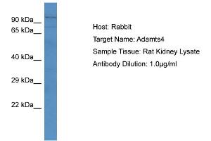 Host: RabbitTarget Name: Adamts4Antibody Dilution: 1. (ADAMTS4 Antikörper  (N-Term))