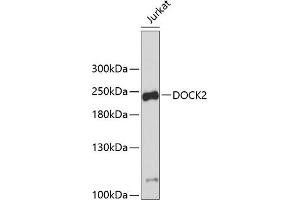 Western blot analysis of extracts of Jurkat cells, using DOCK2 antibody (ABIN1679578, ABIN5664348 and ABIN5664349). (DOCK2 Antikörper  (AA 1551-1830))