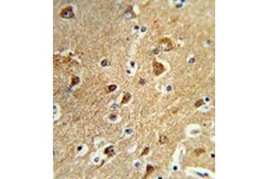 Formalin-fixed and paraffin-embedded human brain tissue reacted with PPM1H Antibody , which was peroxidase-conjugated to the secondary antibody, followed by DAB staining. (PPM1H Antikörper  (Middle Region))