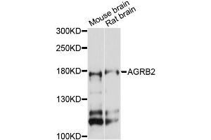 Western blot analysis of extracts of various cell lines, using AGRB2 antibody (ABIN6290298) at 1:3000 dilution. (BAI2 Antikörper)