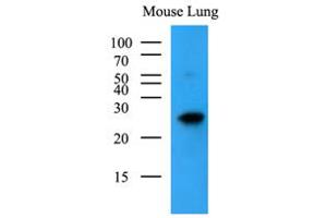 Western Blotting (WB) image for anti-BCL2-Antagonist/killer 1 (BAK1) (AA 29-187) antibody (ABIN492384)