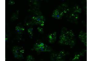 Image no. 6 for anti-Proteasome (Prosome, Macropain) 26S Subunit, ATPase, 3 (PSMC3) antibody (ABIN1501331) (PSMC3 Antikörper)