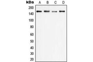 Western blot analysis of PLC gamma 1 expression in HEK293T (A), HeLa (B), SP2/0 (C), PC12 (D) whole cell lysates. (Phospholipase C gamma 1 Antikörper  (Center))
