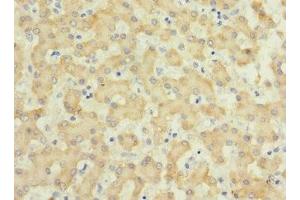 Immunohistochemistry of paraffin-embedded human liver tissue using ABIN7156807 at dilution of 1:100 (IL17 Receptor B Antikörper  (AA 18-292))