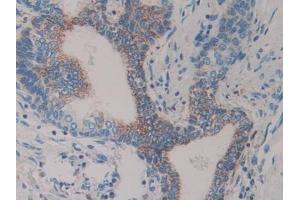 Immunohistochemistry (IHC) image for anti-Slit Homolog 1 (SLIT1) (AA 603-773) antibody (ABIN7438100)