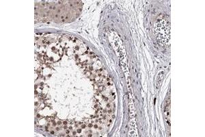 Immunohistochemical staining of human testis with RNF44 polyclonal antibody  shows moderate nuclear positivity in cells in seminiferus ducts at 1:20-1:50 dilution. (RNF44 Antikörper)