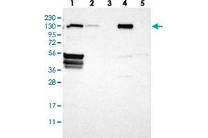 Western blot analysis of Lane 1: RT-4, Lane 2: U-251 MG, Lane 3: Human Plasma, Lane 4: Liver, Lane 5: Tonsil with FLII polyclonal antibody  at 1:250-1:500 dilution. (FLII Antikörper)