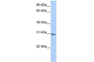 WB Suggested Anti-ABHD13 Antibody Titration:  0. (ABHD13 Antikörper  (N-Term))