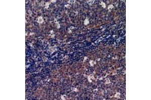 Immunohistochemical analysis of p47 phox staining in human tonsil formalin fixed paraffin embedded tissue section. (NCF1 Antikörper  (C-Term))